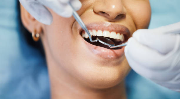 Best Chipped Tooth Repair Near Me  in Silver Lake, NC